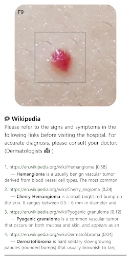 Model Dermatol डाउनलोड करें – स्किन डिजीज चेक और इमेज एटलस - Screenshot 5