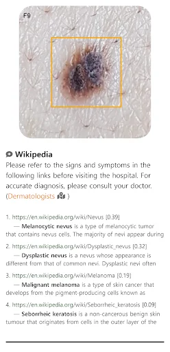 Model Dermatol डाउनलोड करें – स्किन डिजीज चेक और इमेज एटलस - Screenshot 3