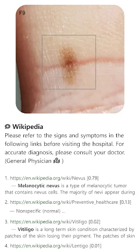 Model Dermatol डाउनलोड करें – स्किन डिजीज चेक और इमेज एटलस - Screenshot 10