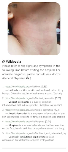 Model Dermatol डाउनलोड करें – स्किन डिजीज चेक और इमेज एटलस - Screenshot 6