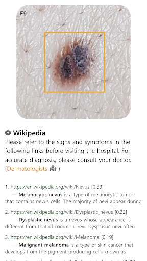 Model Dermatol डाउनलोड करें – स्किन डिजीज चेक और इमेज एटलस - Screenshot 9